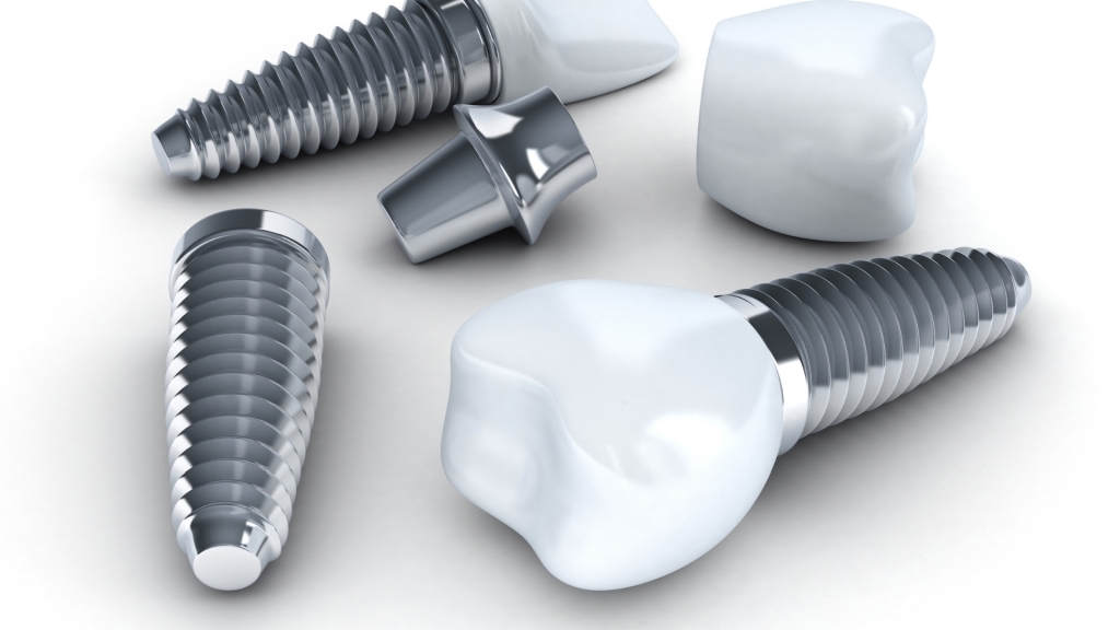 implant zęba cena