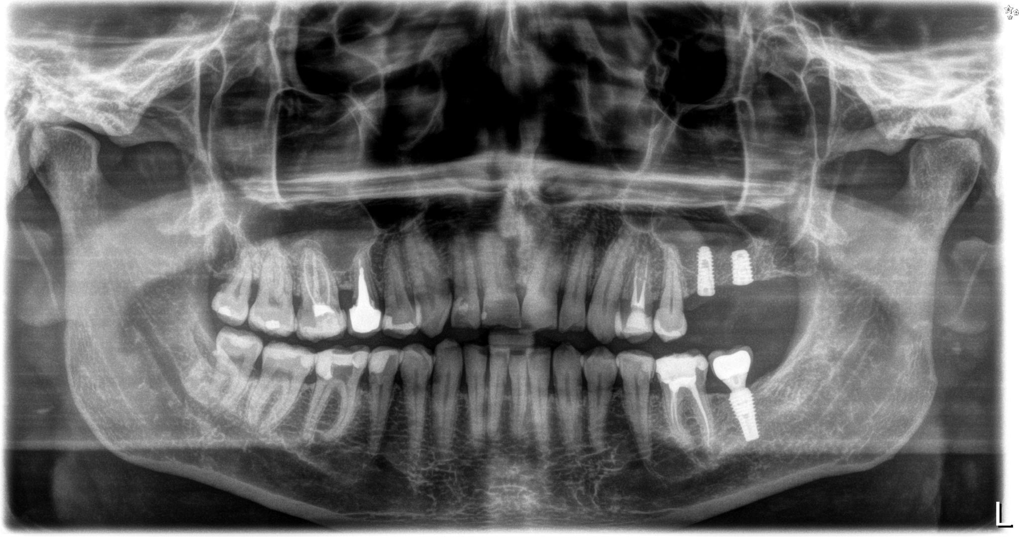 implantologia białystok
