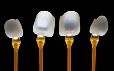 Przewodnik po&nbsp;stomatologii estetycznej – Jak poprawić wygląd swojego uśmiechu?