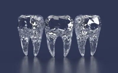 Licówki czy&nbsp;bonding?