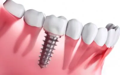 Implantolog Białystok