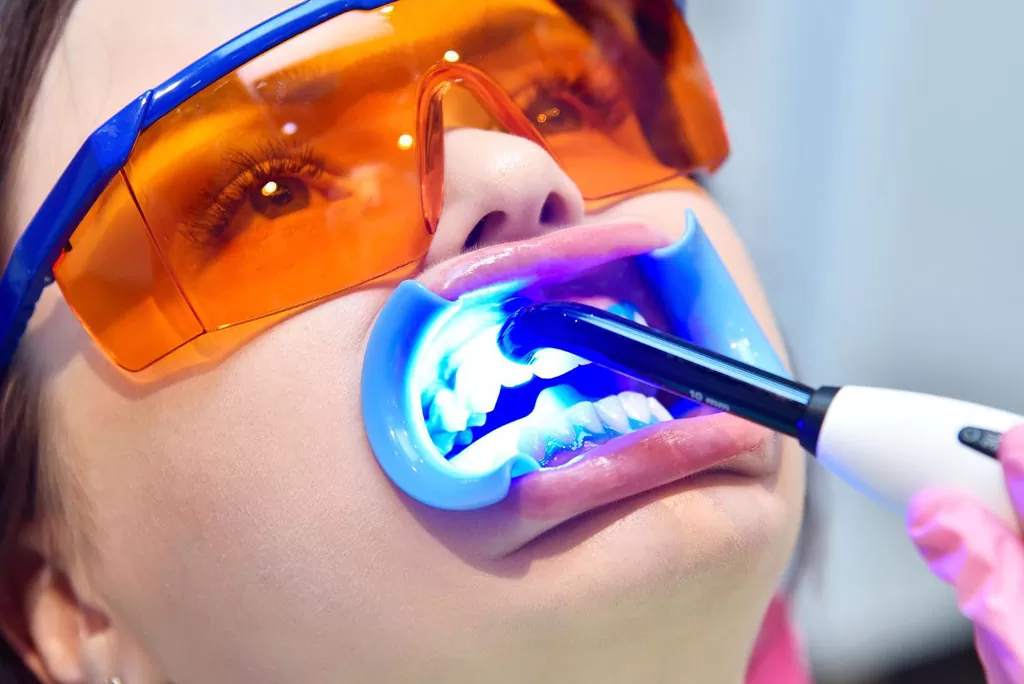 wybielanie zębów białystok