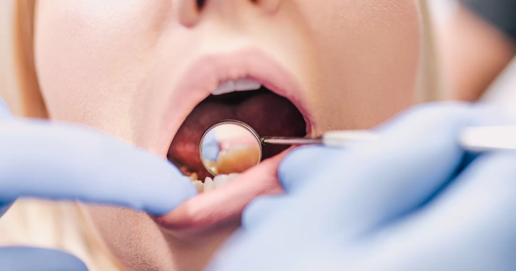 piaskowanie zębów białystok